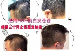 多久可以体验到Somaderm凝胶效果? 附张密林教授讲解
